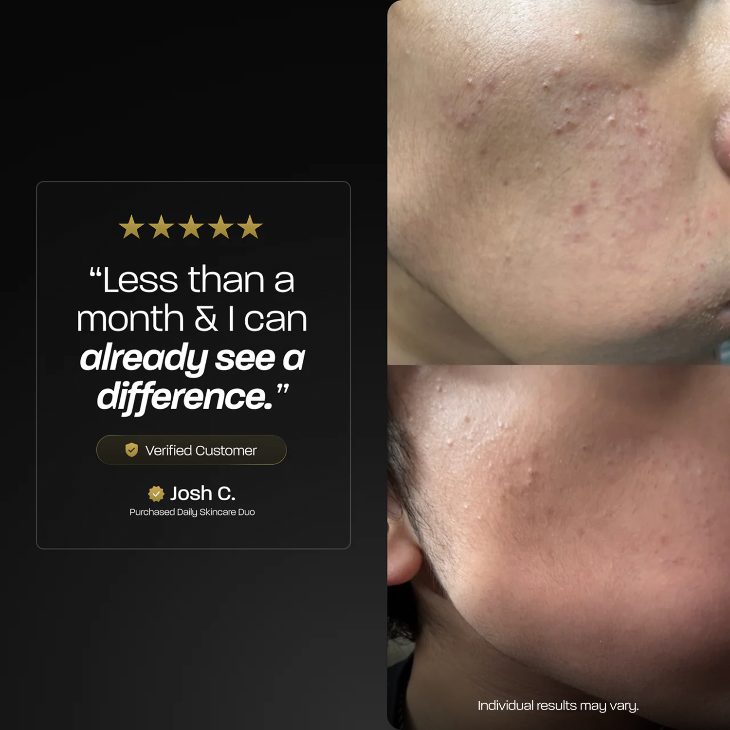 Alternative view of Daily Skincare Duo
